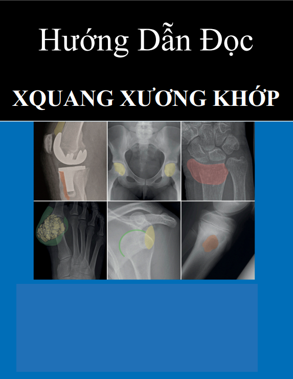 [VIP] Hướng dẫn đọc Xquang xương khớp
